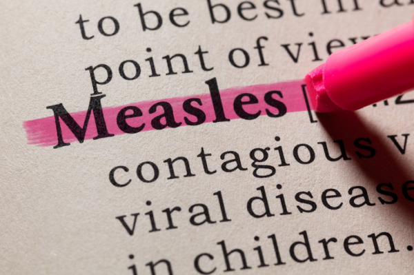 4 things everyone needs to know about measles